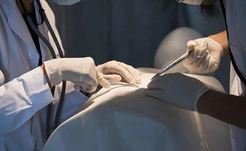 炎性乳腺肿瘤病程多久